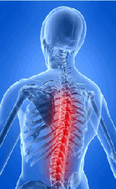 Imagen de la esclerosis múltiple