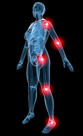Imagen de la fibromialgia