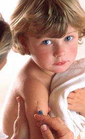 meningitis Imagen de la meningitis
