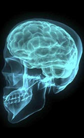 tumor cerebral Imagen de la tumor cerebral